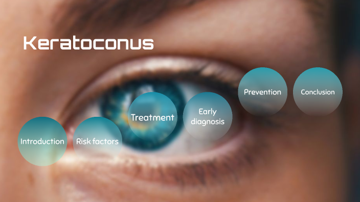 Keratoconus by 5A-29 YAU YI YAN on Prezi