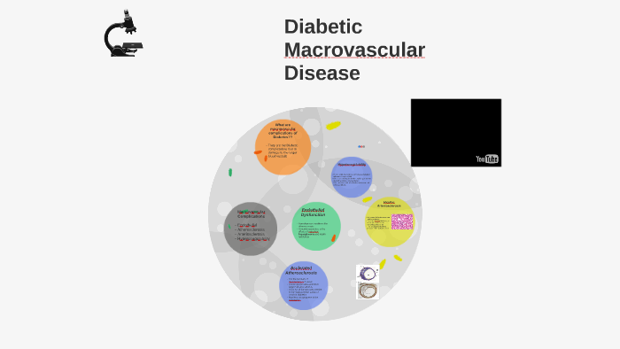 Diabetic Macrovascular Disease by TABISH KHAN