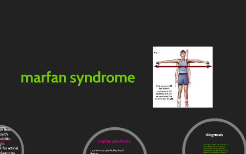 marfan syndrome by briyonna curtis