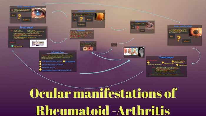 ocular presentation of rheumatoid arthritis