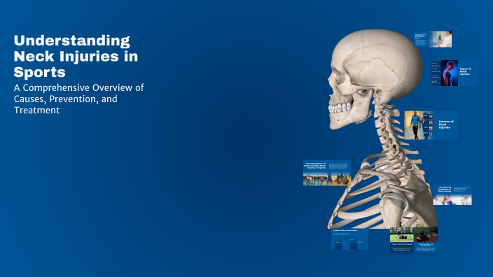 Understanding Neck Injuries in Sports by Sarah Otieno on Prezi