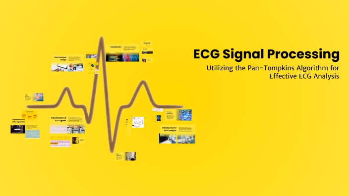 ECG Signal Processing by S3 D on Prezi