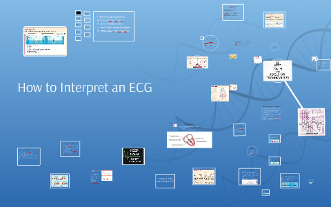 How To Interpret An Ecg By Rattan Jugdoyal On Prezi Next