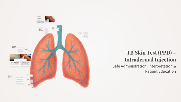 TB Skin Test (PPD) – Intradermal Injection by Kelsey Crayton on Prezi