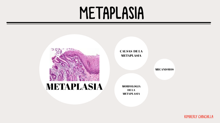 Que Es La Metaplasia Que Es La Metaplasia