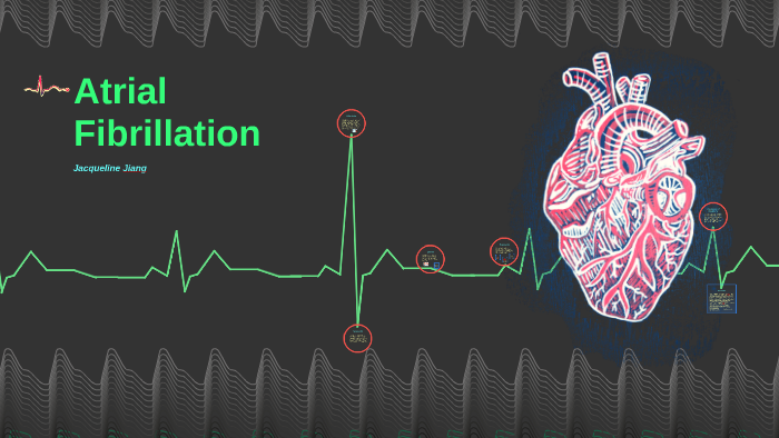 Atrial Fibrillation by Jacqueline Jiang on Prezi