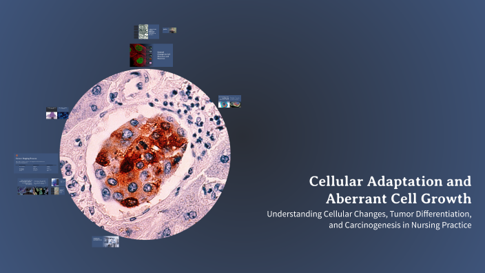 Cellular Adaptation and Aberrant Cell Growth by Ejaz ali khan on Prezi
