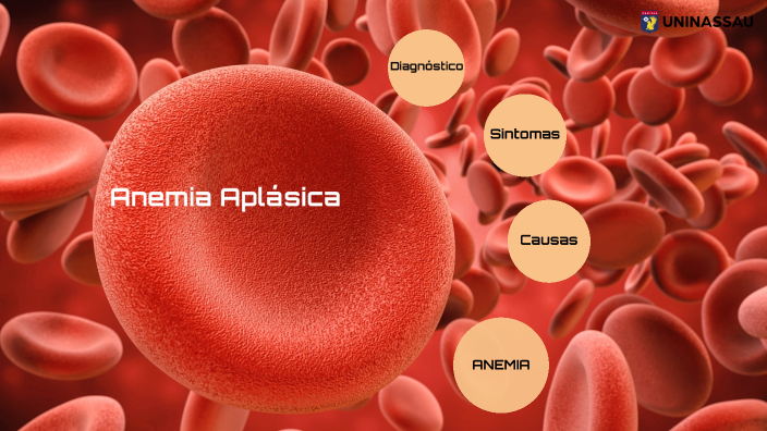 Anemia aplásica by lauriany marcelino on Prezi