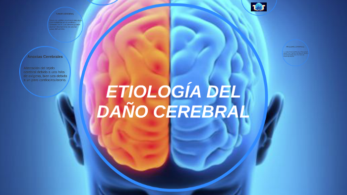 ETIOLOGÍA DEL DAÑO CEREBRAL by Daniela Zamora on Prezi