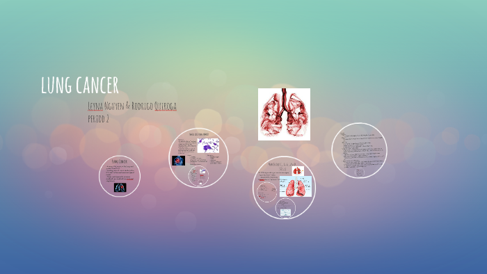 lung cancer by on Prezi