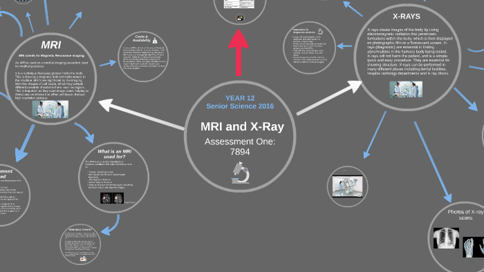 MRI & XRAY Assessment Year 12 HSC by on Prezi