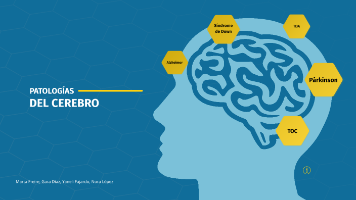 PATOLOGÍAS DEL CEREBRO by Gara Díaz on Prezi