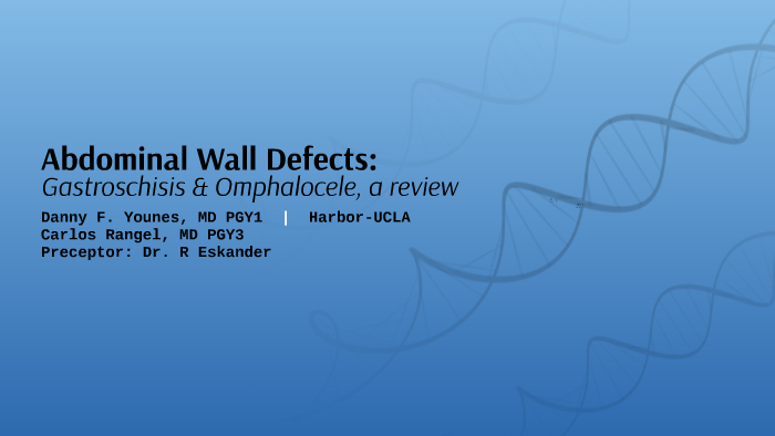 Anterior Abdominal Defects by Danny Younes on Prezi