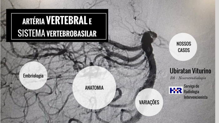 Artéria Vertebral e Sistema Vertebrobasilar by Ubiratan Viturino