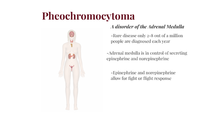 Pheochromocytoma By Kate Hammett