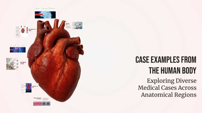 Case Examples from the Human Body by Emilie Davignon on Prezi