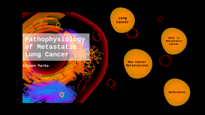 Pathophysiology of Metastatic Lung Cancer by Alison Parke on Prezi