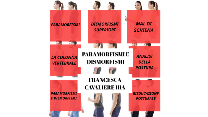 Paramorfismi e Dismorfismi della Colonna Vertebrale - Francesca