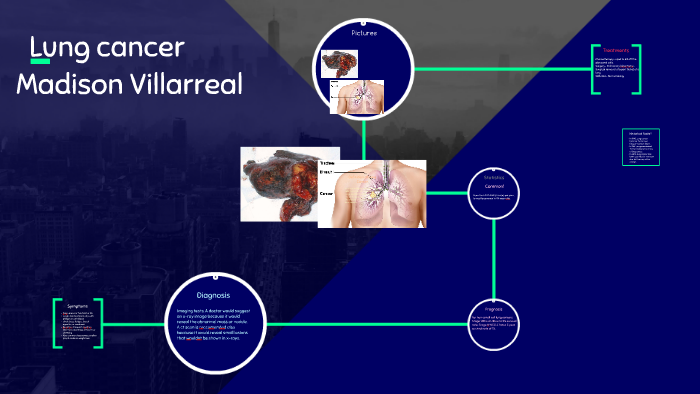 Lung cancer by madison villarreal on Prezi