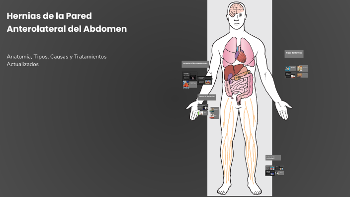 Hernias de la Pared Anterolateral del Abdomen by Juan Nuñez on Prezi