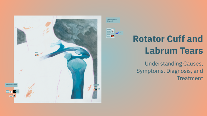 Rotator Labrum Rotator Cuff and Labrum Tears by Wade Lunsford on Prezi