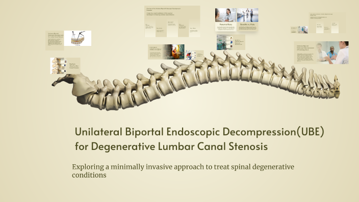 Unilateral Biportal Endoscopic Decompression for Degenerative Lumbar ...
