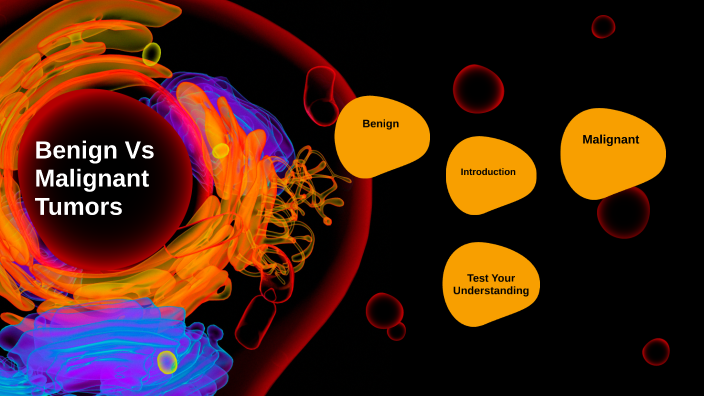 Benign VS Malignant Tumors by Amy Wang on Prezi