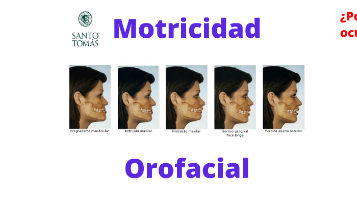 Motricidad Orofacial, Fonoaudiología UST 2016 By Rodrigo Palza On Prezi