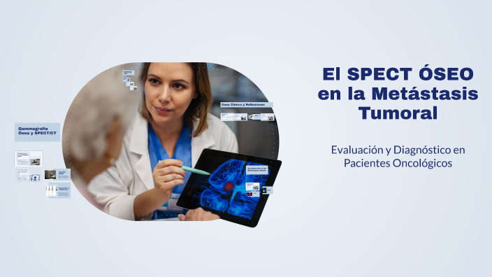 El SPECT ÓSEO en la Metástasis Tumoral by manuel novas on Prezi
