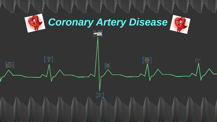 Coronary Artery Disease by Rawan Abhari