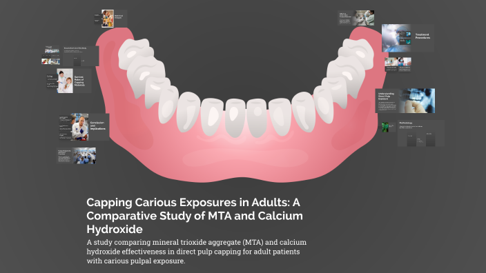 Capping Carious Exposures in Adults: A Comparative Study of MTA and ...