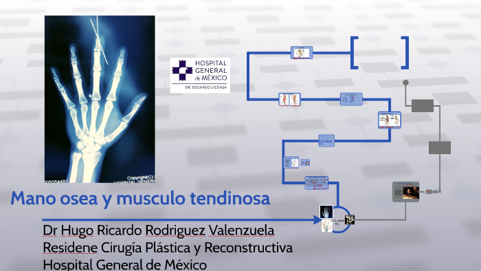lesiones de muneca y mano brotzman
