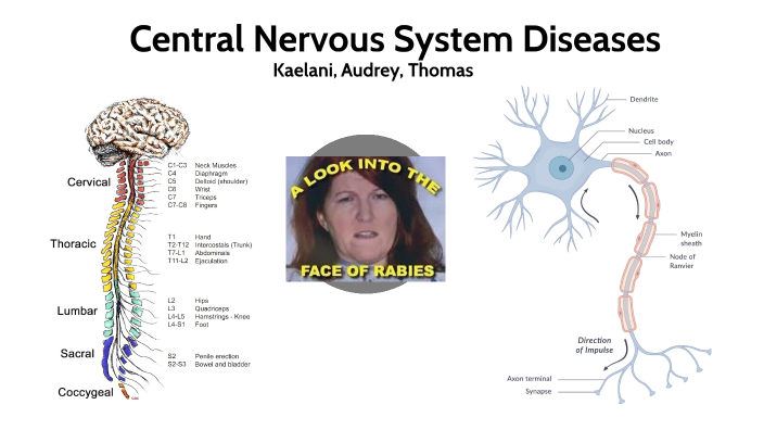 CNS Diseases by Thomas Effeny