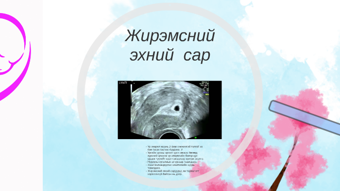 Жирэмсний эхний гурван сар by Narantsatsral Khashbat on Prezi
