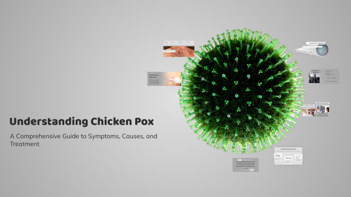 Understanding Chicken Pox by Isabella Piferi on Prezi