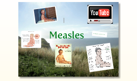 measles powerpoint presentation download