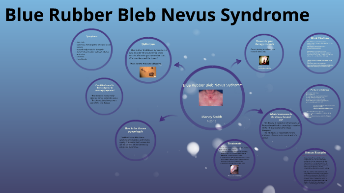 Blue Rubber Bleb Nevus Syndrome Wikipedia