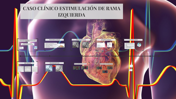 ESTIMULACI N RAMA IZQUIERDA By Diana Garcia Gonzalez On Prezi estimulaci-n-rama-izquierda-by-diana-garcia-gonzalez-on-prezi