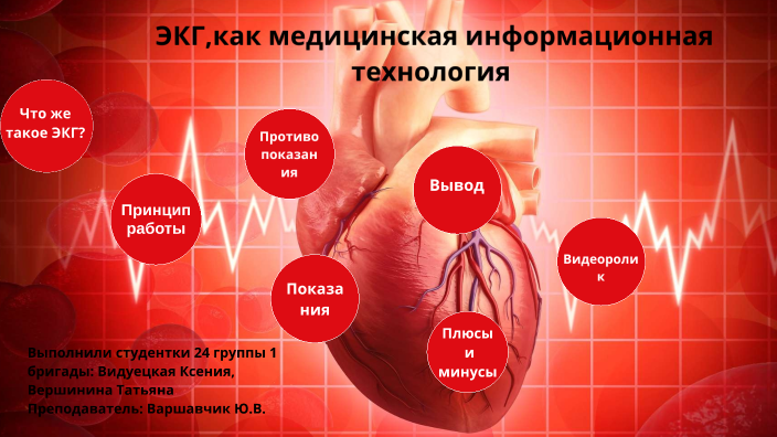 ЭКГ by Ксения Видуецкая on Prezi