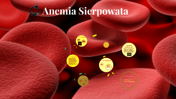 Anemia Sierpowata By Anna Kryjak 0178