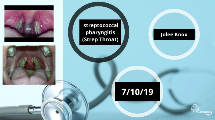 Streptococcal Pharyngitis By Jolee Knox On Prezi
