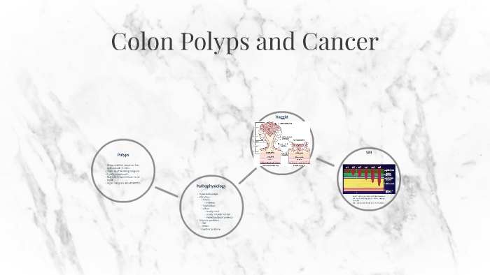 Colon Polyps and Cancer by Benjamin Cragun on Prezi