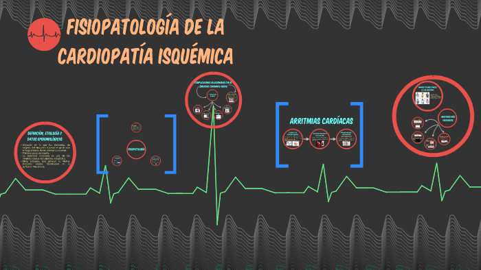 Fisiopatología De La Cardiopatía Isquémica By Maria Vivas On Prezi 4645