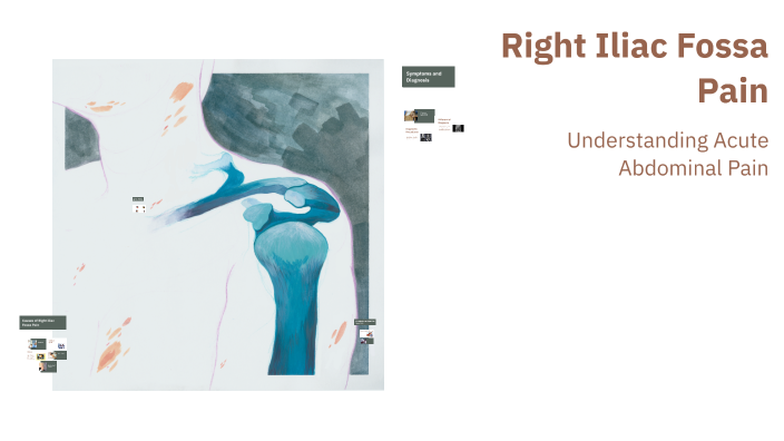 Right Iliac Fossa Pain by Mona shoeb on Prezi
