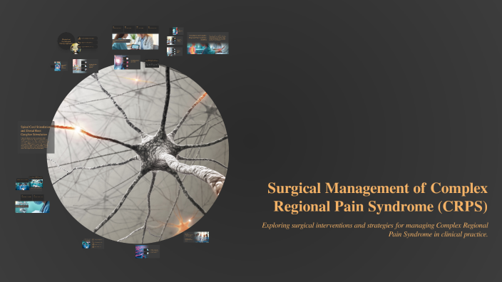 Surgical Management of Complex Regional Pain Syndrome (CRPS) by valery ...