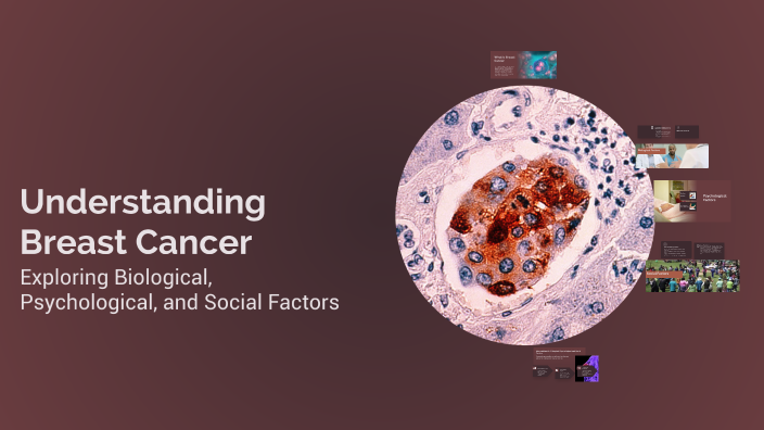 Understanding Breast Cancer by Vanessa Lobo on Prezi