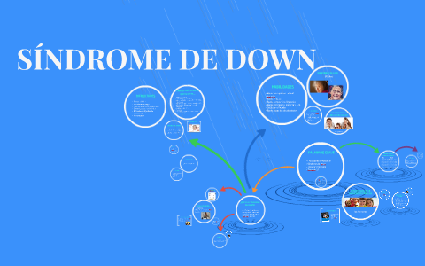 SÍNDROME DE DOWN by Nazaret Garrido