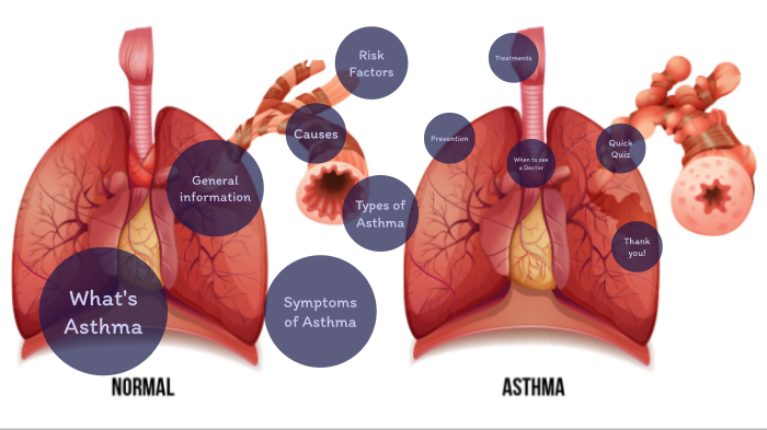 Asthma by izzy Davis