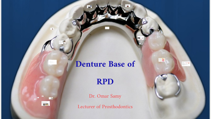 Latice Base Rpd Denture Base of RPD Dr. Omar Samy Lecturer of Prosthodontics by Omar ...