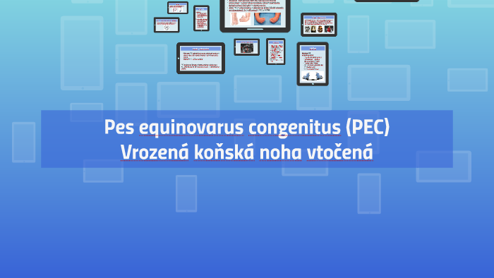 Pes equinovarus congenitus by Michal Fořt on Prezi